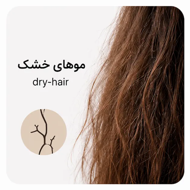 ماسک مو
